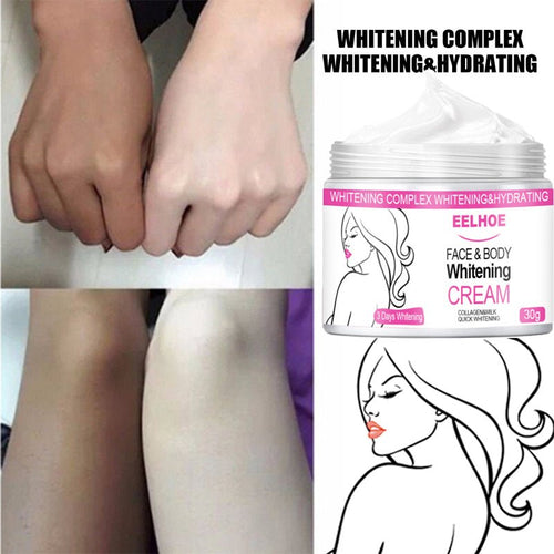 Body Whitening Cream Underarm Armpit Knee Dark Skin Whitening Moisturizing Brighten Body Lotion - Starttech Online Market