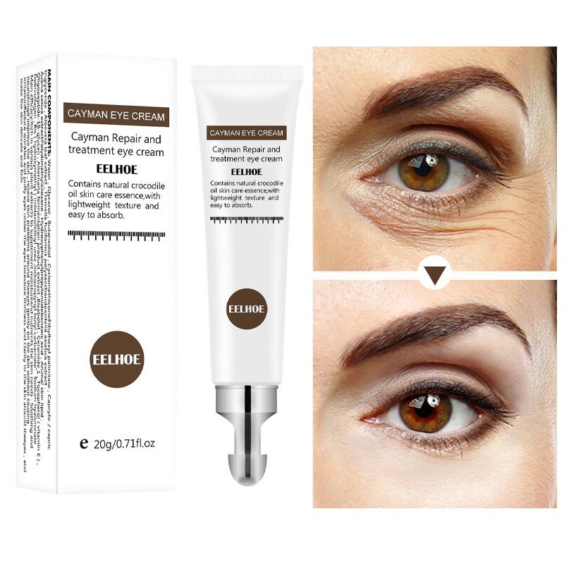 Instant Remove Dark Circles Eye Cream Anti Wrinkles Eye Serum Lift Firm Moisturizing Brighten Contour - Starttech Online Market