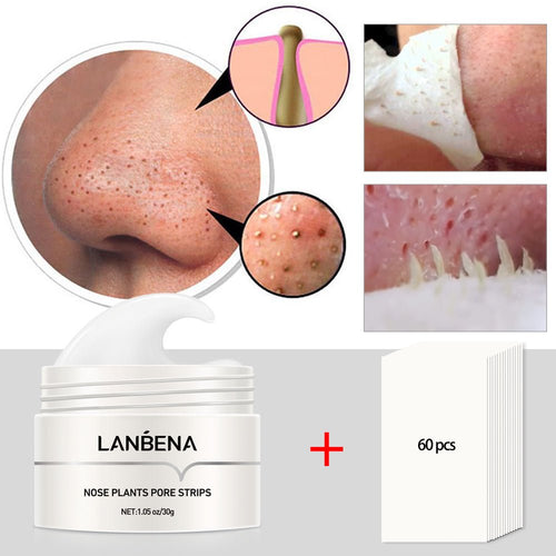 LANBENA Blackhead Remover Nose Masks Skin Care Pore Strip Tearing Black Mask Acne Peeling Treatment Deep Cleansing Cosmetics 30g - Starttech Online Market