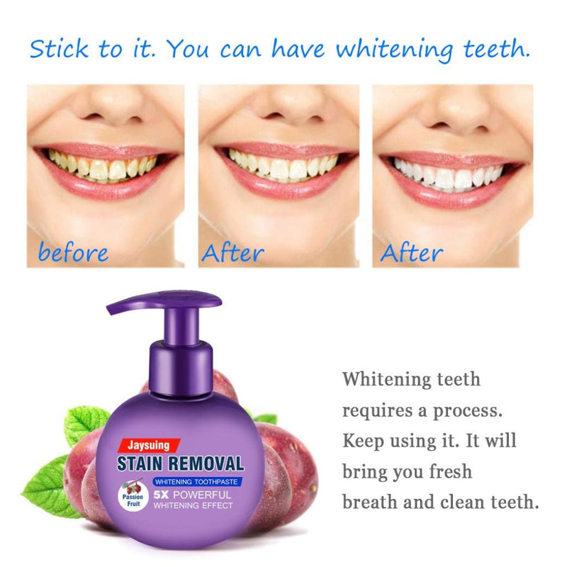 Stain Removal Whitening Toothpaste Fight Bleeding Gums Toothpaste - Starttech Online Market